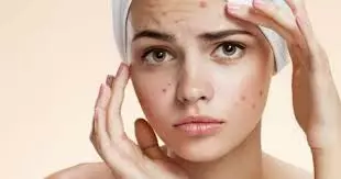 Manfaat minyak zaitun untuk kulit © 2020 brilio.net