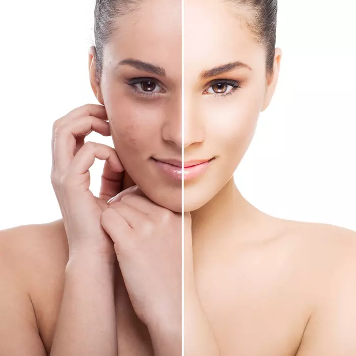 Manfaat minyak zaitun untuk kulit © 2020 brilio.net