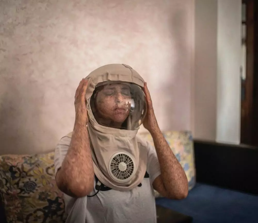 Kisah wanita pakai helm 20 tahun jika ke luar rumah © 2020 brilio.net Kisah wanita pakai helm 20 tahun jika ke luar rumah © 2020 brilio.net