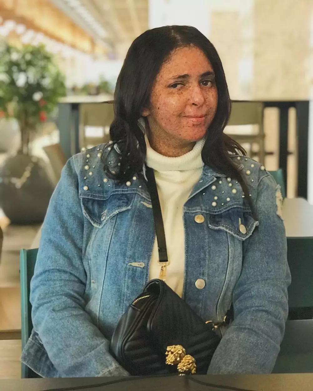 Kisah wanita pakai helm 20 tahun jika ke luar rumah © 2020 brilio.net Kisah wanita pakai helm 20 tahun jika ke luar rumah © 2020 brilio.net