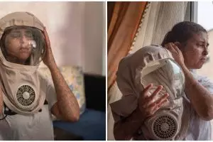 Kisah wanita pakai helm 20 tahun jika ke luar rumah, ini 8 potretnya