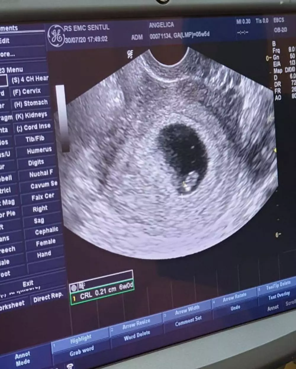 Angelica Simperler hamil Instagram