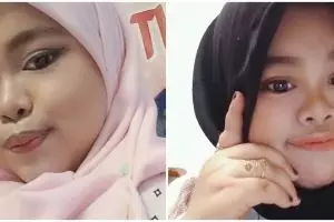 Kakinya diinjak sapi, ini 5 momen Kekeyi jalani perawatan