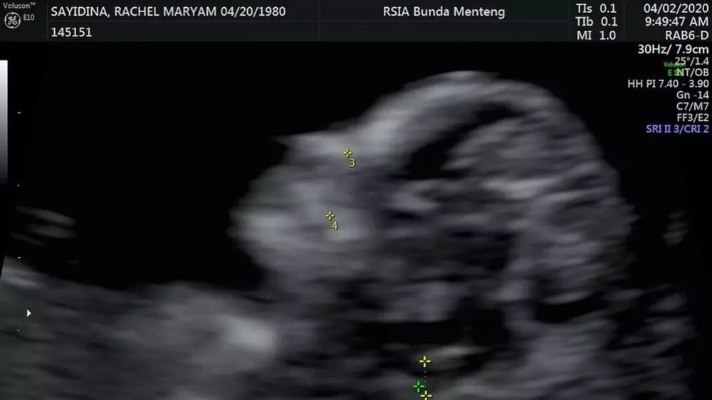 Fakta Rachel Maryam Instagram