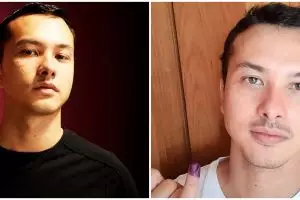 Nicholas Saputra pamer kaki di Instagram, warganet heboh