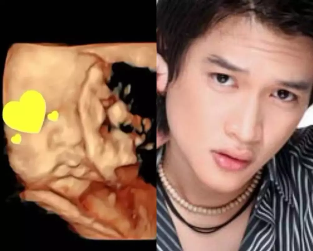 Rezky Adhitya unggah wajah calon bayinya © 2020 brilio.net