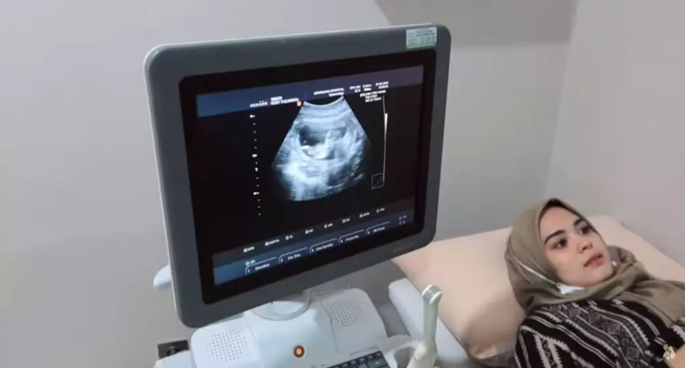 Vebby Palwinta umumkan kehamilan YouTube