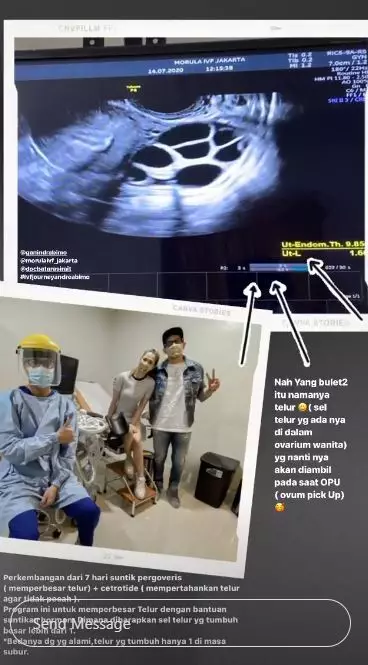 Momen Andrea Dian jalani program bayi tabung © 2020 Instagram