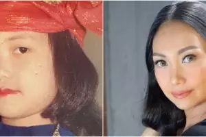 7 Potret transformasi Nola B3 dari kecil hingga kini, cantiknya awet