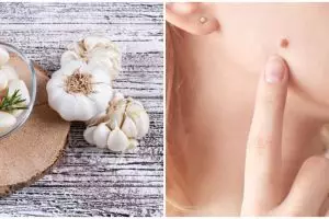 8 Manfaat bawang putih untuk kulit, atasi keriput dan peradangan