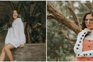 Idap skoliosis sejak SMP, ini curahan hati Jessica Mila