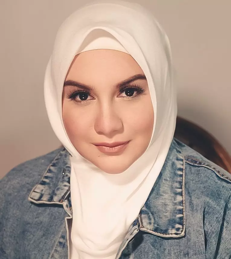 perubahan wajah Irish Bella © 2020 brilio.net Instagram