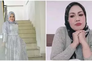 8 Potret terbaru Elly Sugigi usai pengencangan wajah, makin tirus