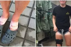 Kelamaan berjemur, 10 potret perubahan kulit warganet ini bikin ngakak