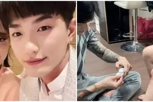 Moa Aeim ditabrak motor saat bersepeda, ini potret kondisinya