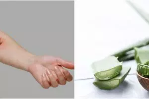 7 Bahan alami untuk menghilangkan gatal kulit, ampuh dan mudah dipakai