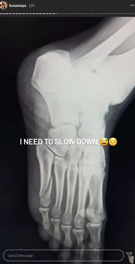 potret kondisi Luna Maya © 2020 Instagram/@lunamaya