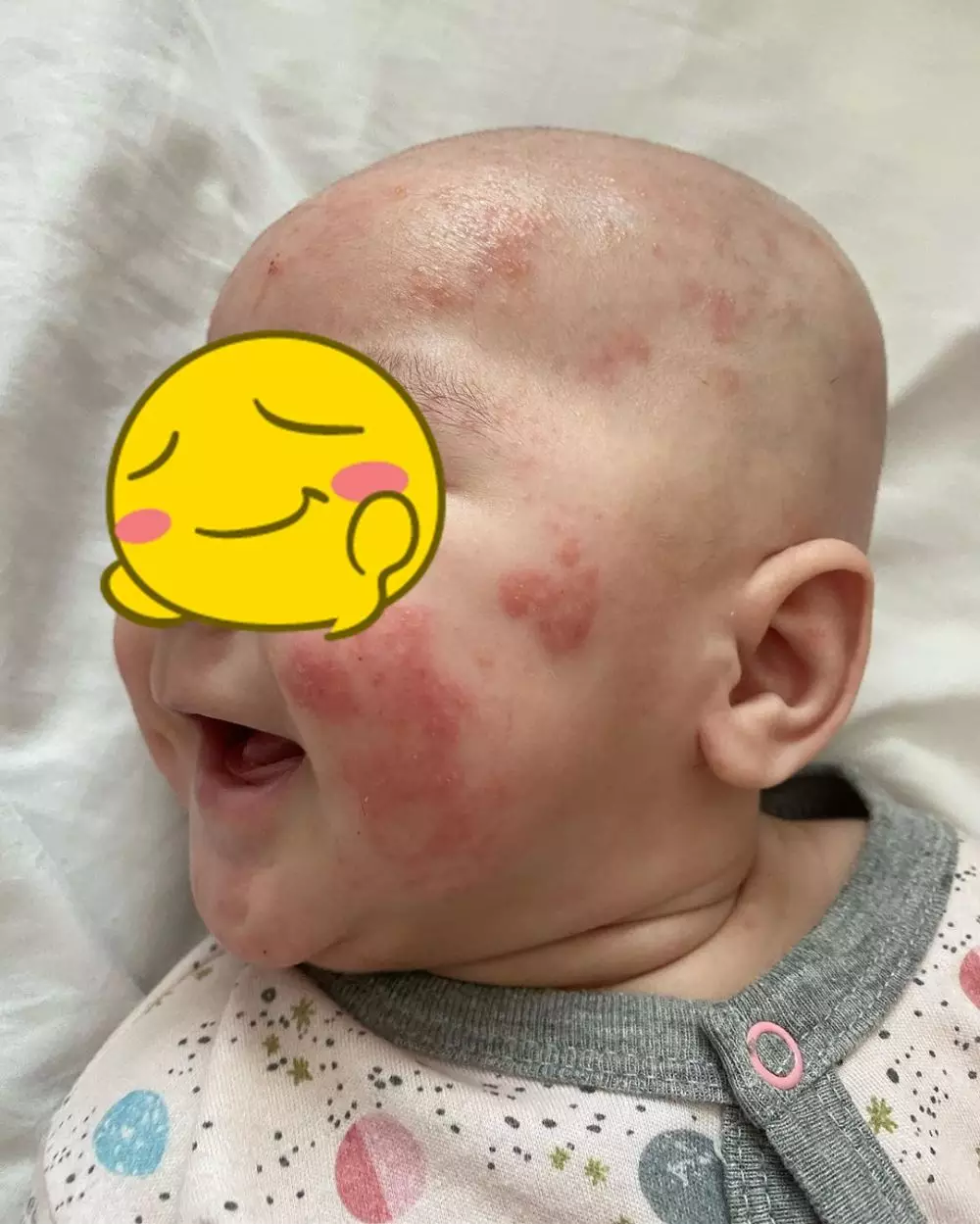 Potret perjuangan Mona Ratuliu © 2020 Instagram/@monaratuliu