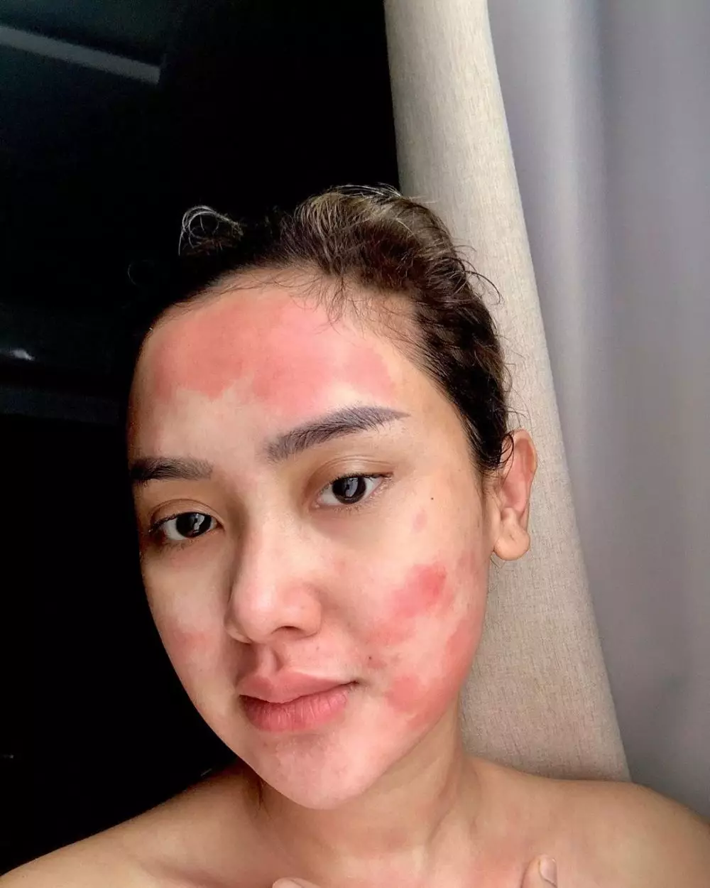 Potret perjuangan Cita Citata lawan amandel © 2020 Instagram