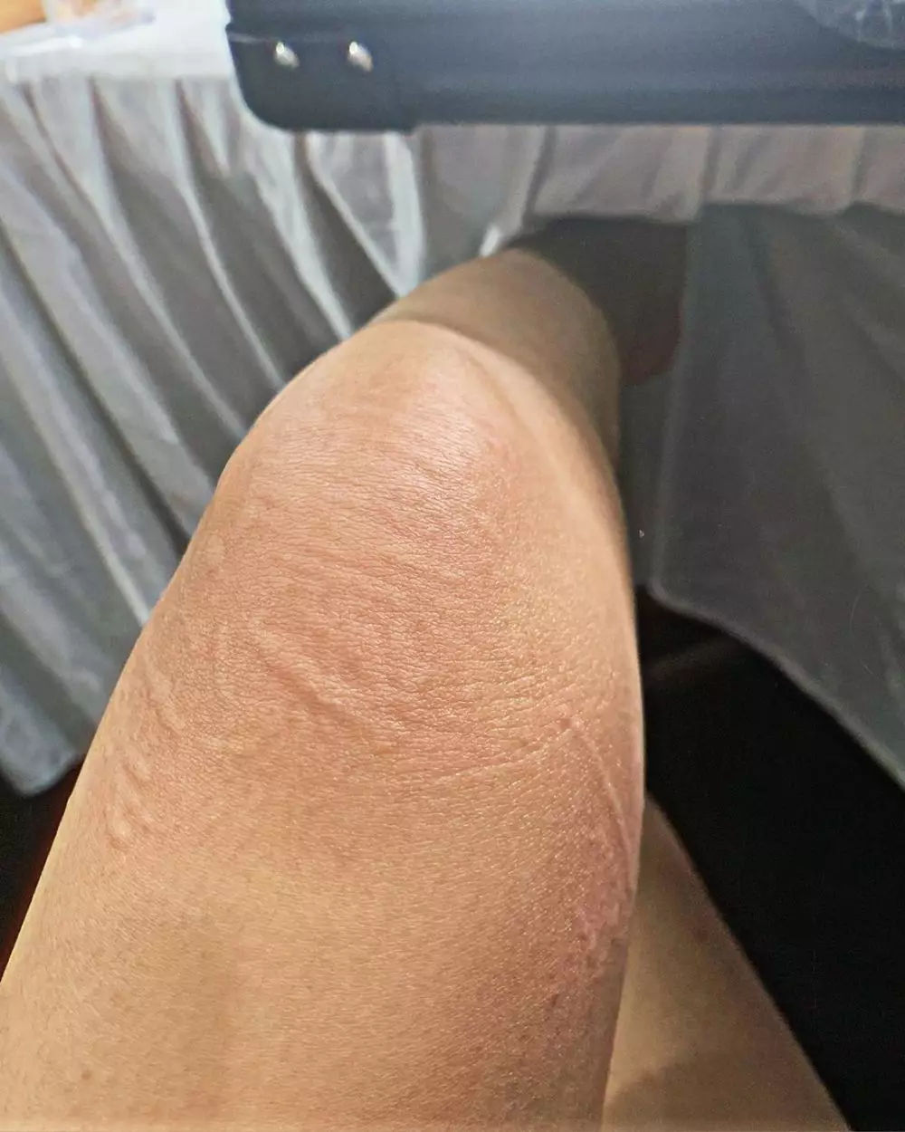 Potret perjuangan Cita Citata lawan amandel © 2020 Instagram