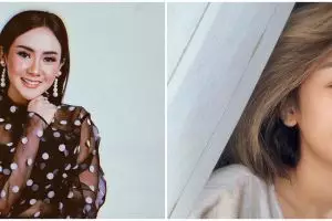 8 Potret perjuangan Cita Citata lawan amandel sampai harus operasi