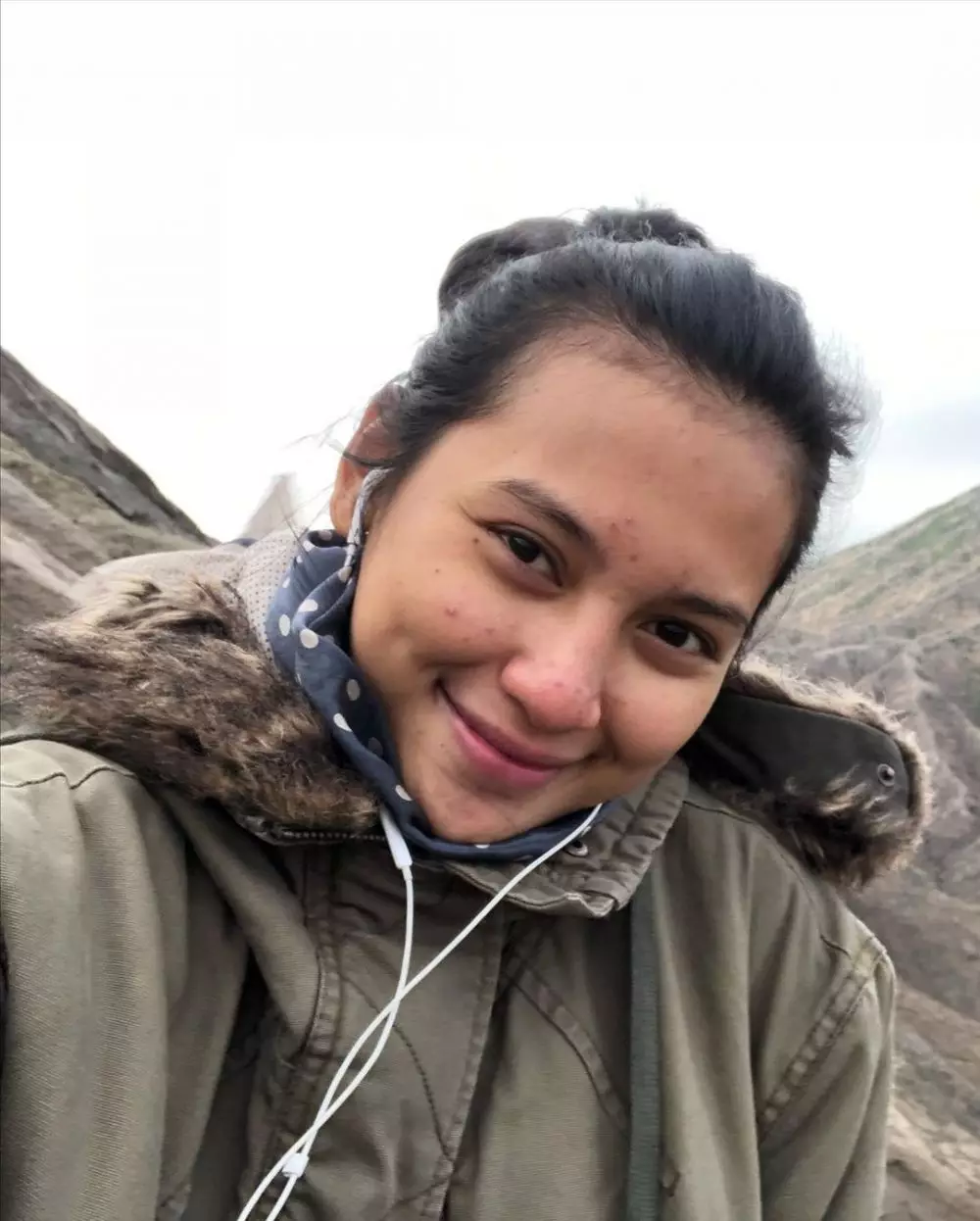 Indah Permatasari jerawatan Instagram