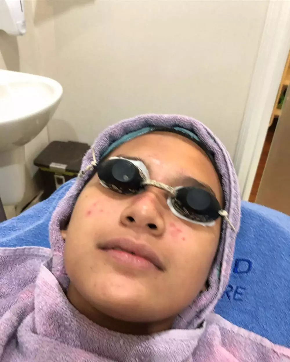 Indah Permatasari jerawatan Instagram