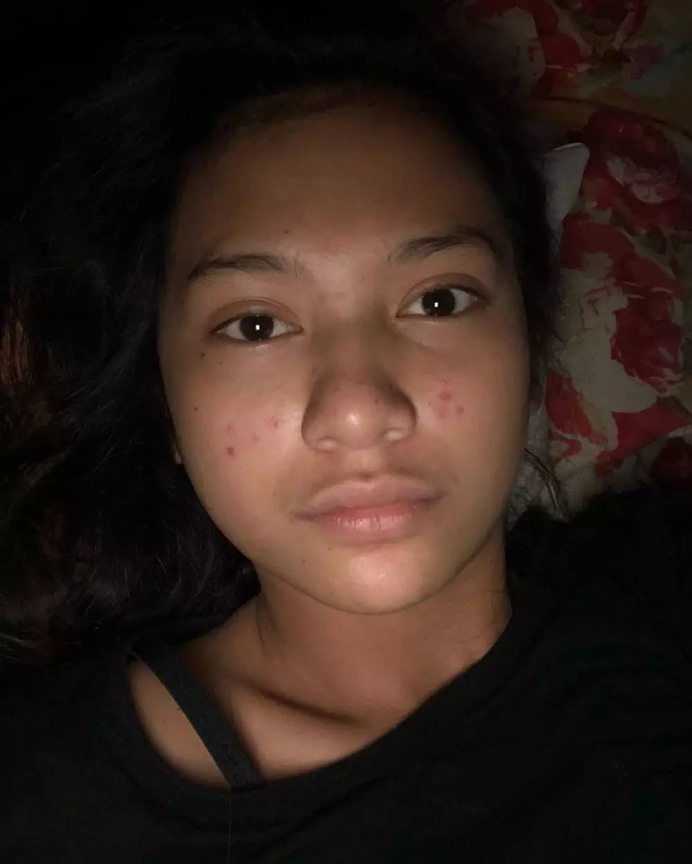 Indah Permatasari jerawatan Instagram