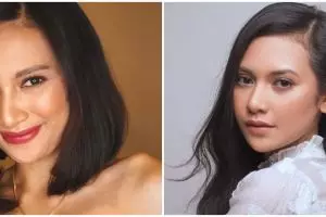 Unggah potret wajah jerawatan, Indah Permatasari tuai pujian