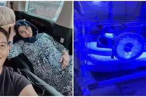 Dua hari dirawat di rumah sakit, begini kondisi bayi Citra Kirana