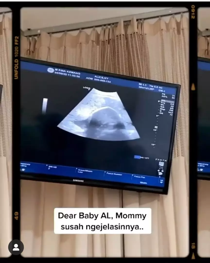 Alice Norin jelang lahiran © 2020 brilio.net Instagram