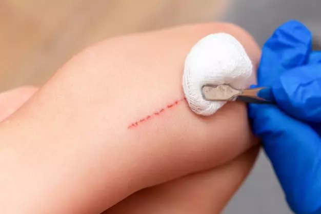 manfaat bunga telang freepik.com