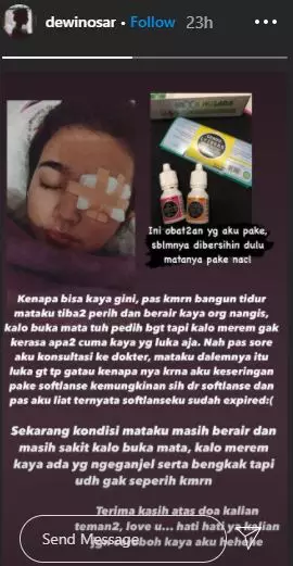 dewi nosar copet cantik Instagram