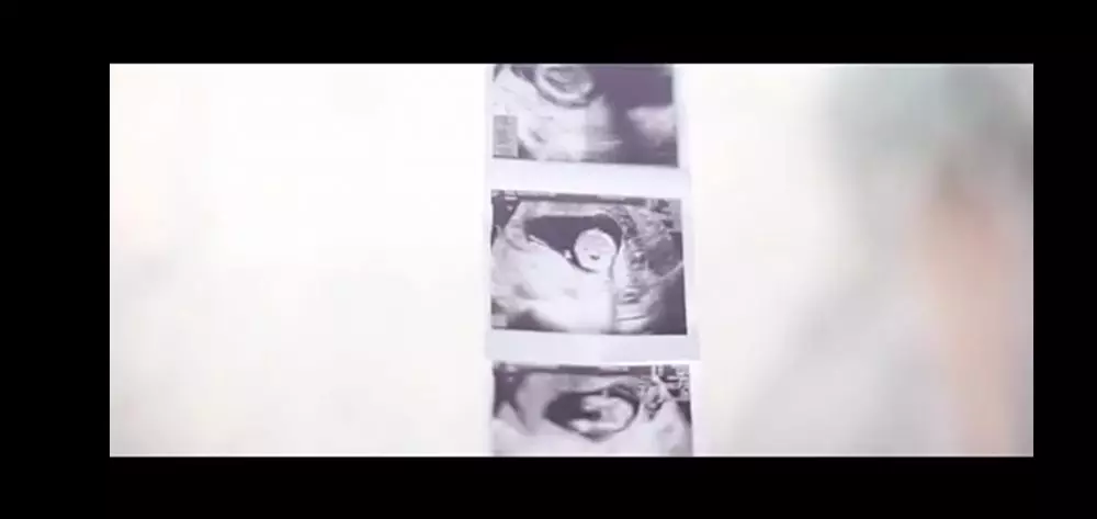 Chelsea umumkan jenis kelamin anak kedua © 2020 brilio.net YouTube Chelsea umumkan jenis kelamin anak kedua © 2020 brilio.net YouTube