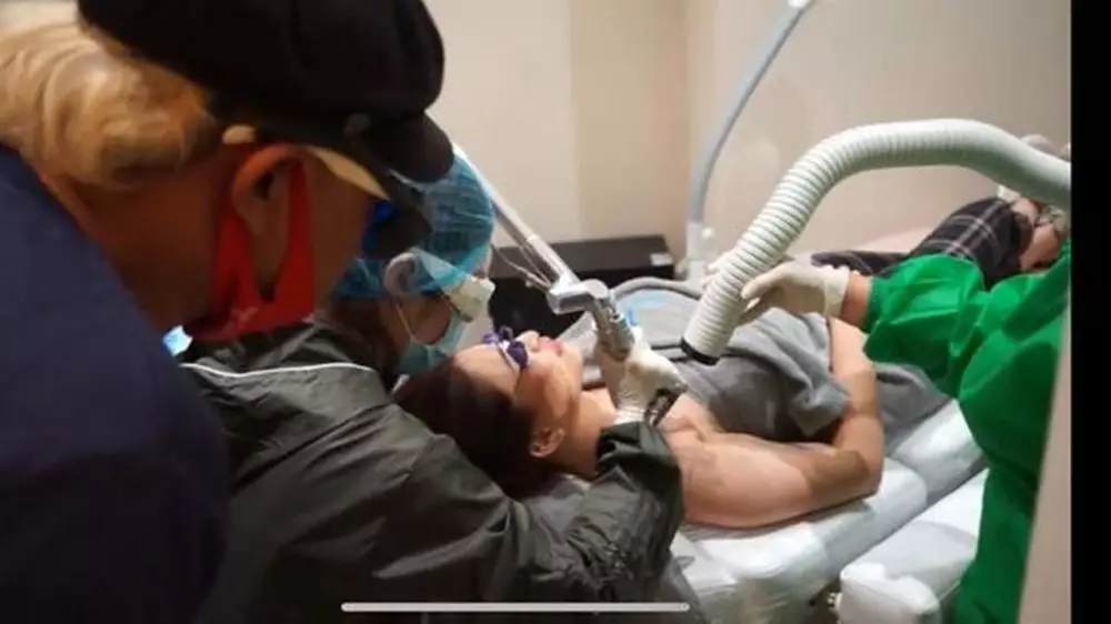 Sule hapus tato Berbagai sumber