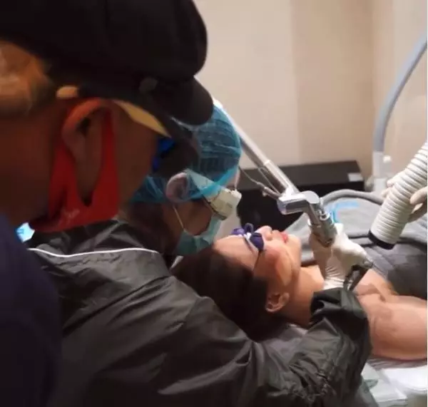 Sule hapus tato Berbagai sumber