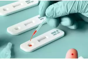 Cara dan syarat mendapatkan surat sehat, praktis dan mudah