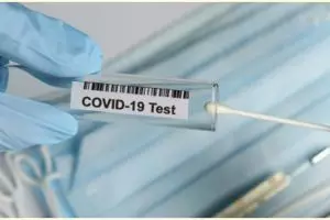 Ini syarat dan biaya ikut rapid test Covid-19, mudah dan cepat