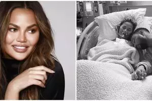 5 Potret sedih Chrissy Teigen di RS usai keguguran & pendarahan hebat