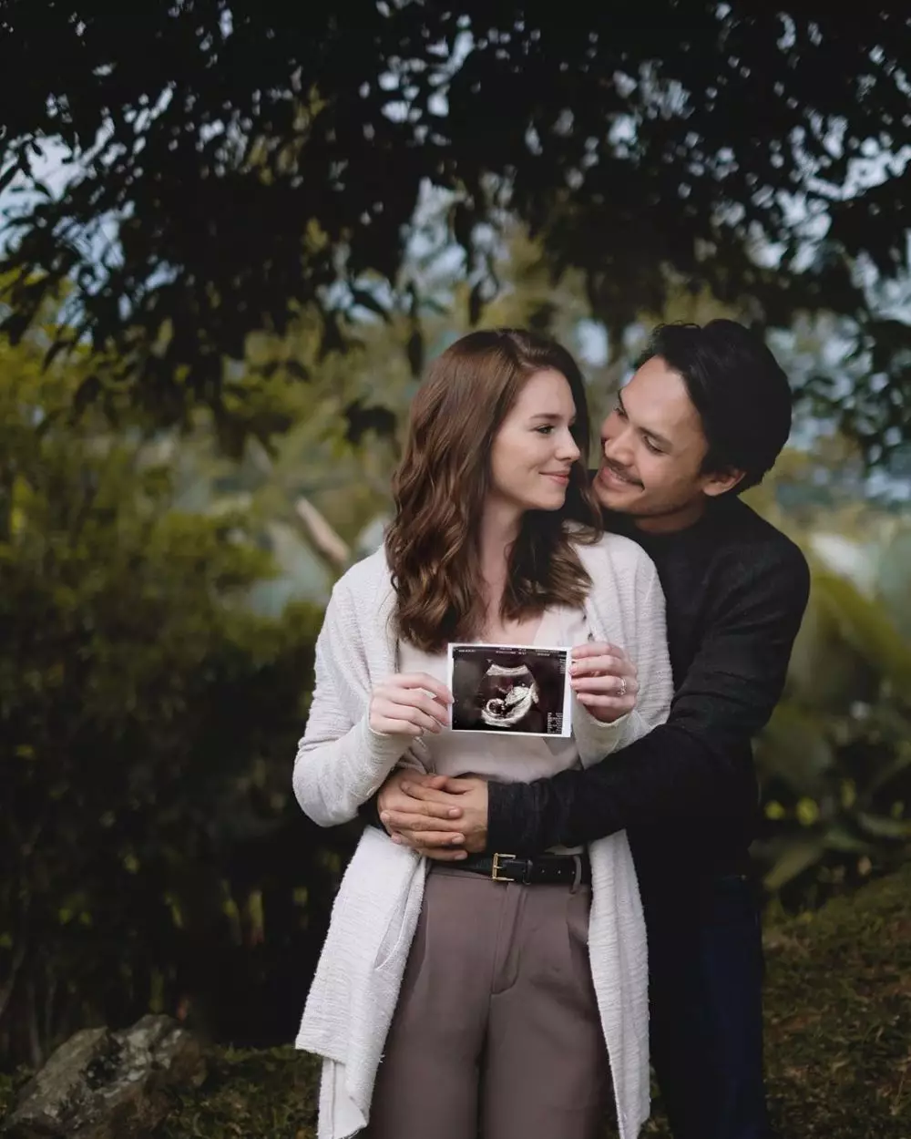 Randy Pangalila dan istri bulenya  Instagram