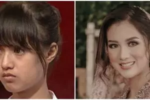 10 Potret transformasi Atries Angel dari kecil hingga akan menikah