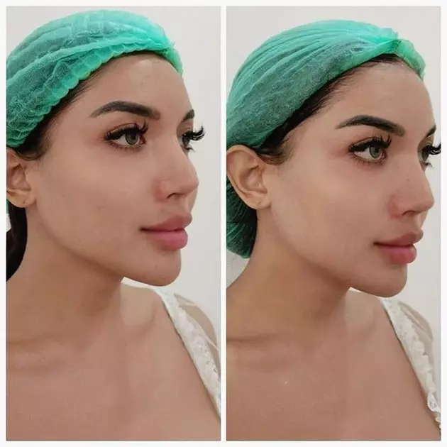 Millen Cyrus perawatan © 2020 brilio.net Instagram