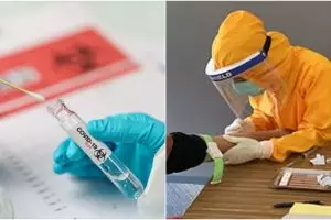 Prosedur penangan pasien Covid-19 sesuai gejala dan kriteria sembuhnya