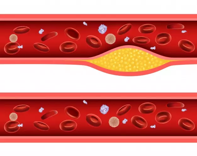 Manfaat daun bidara freepik.com, 