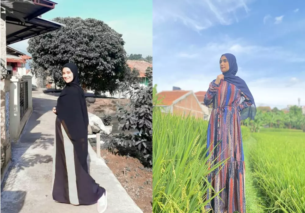 Beda penampilan sebelum dan sesudah terkenal © Instagram 