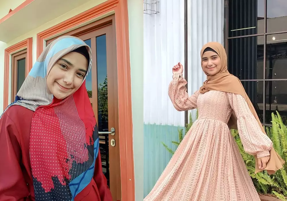 Beda penampilan sebelum dan sesudah terkenal © Instagram 