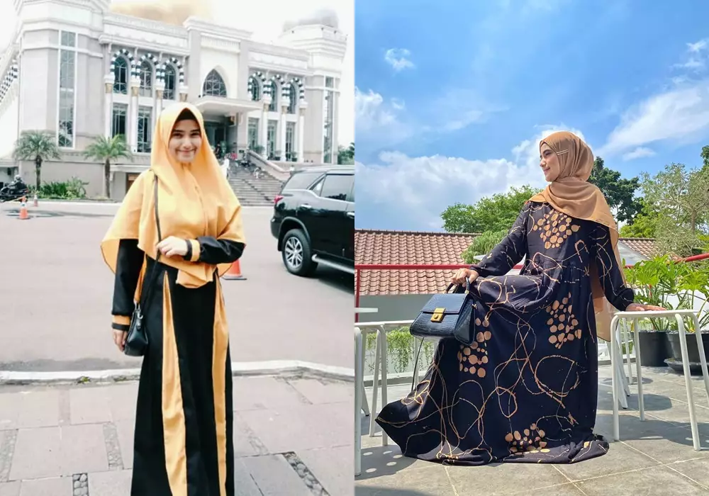 Beda penampilan sebelum dan sesudah terkenal © Instagram 