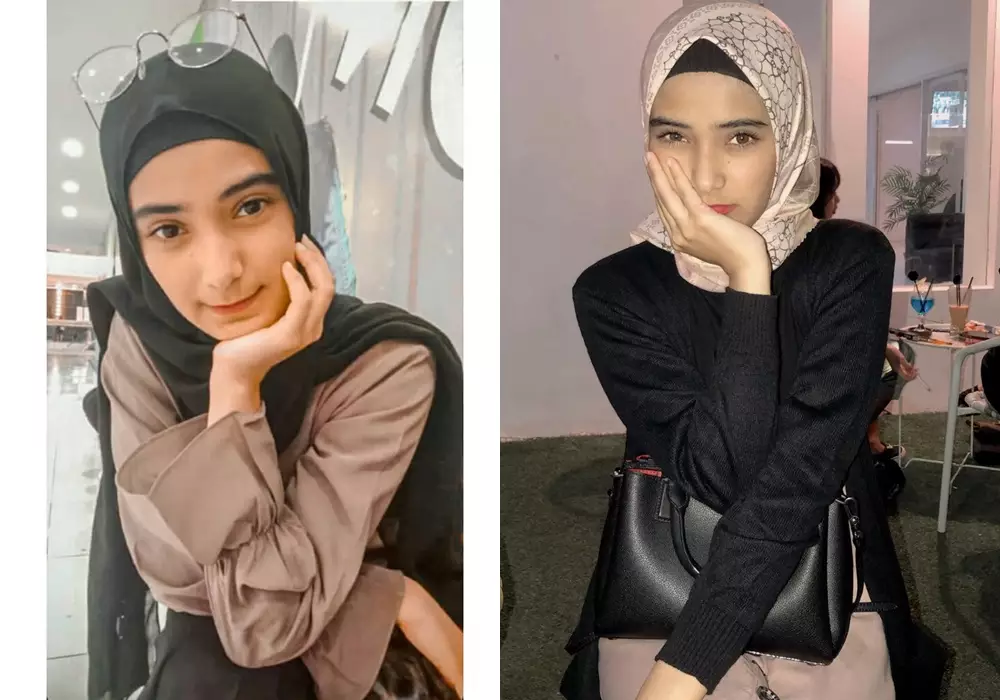 Beda penampilan sebelum dan sesudah terkenal © Instagram 