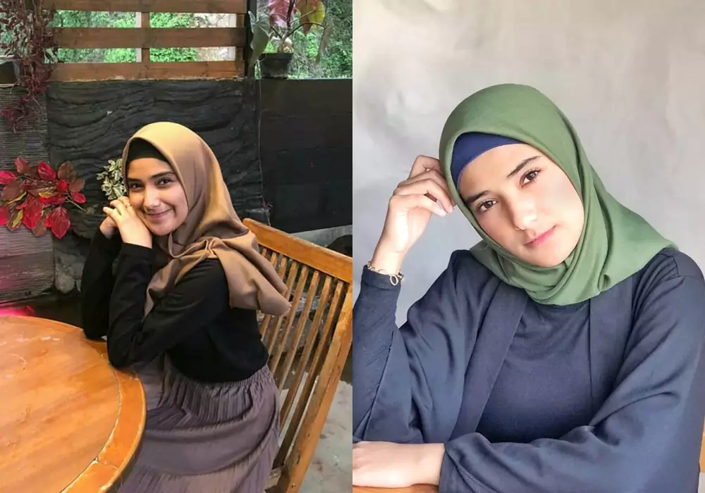 Beda penampilan sebelum dan sesudah terkenal © Instagram 