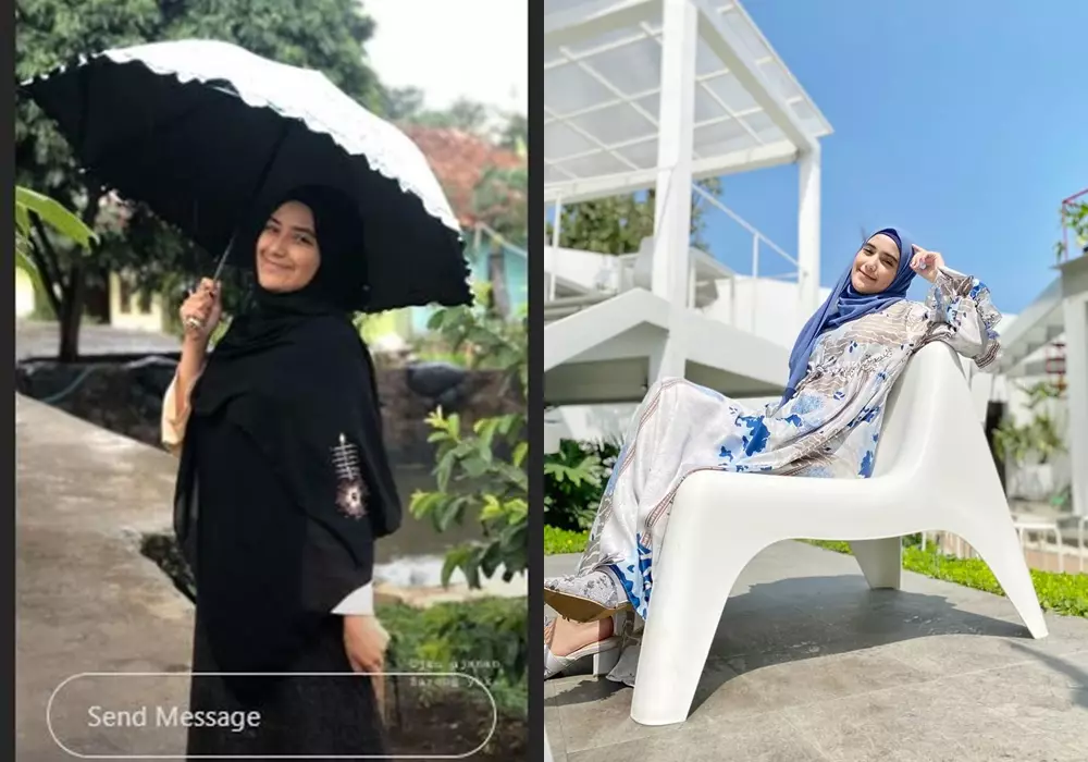 Beda penampilan sebelum dan sesudah terkenal © Instagram 